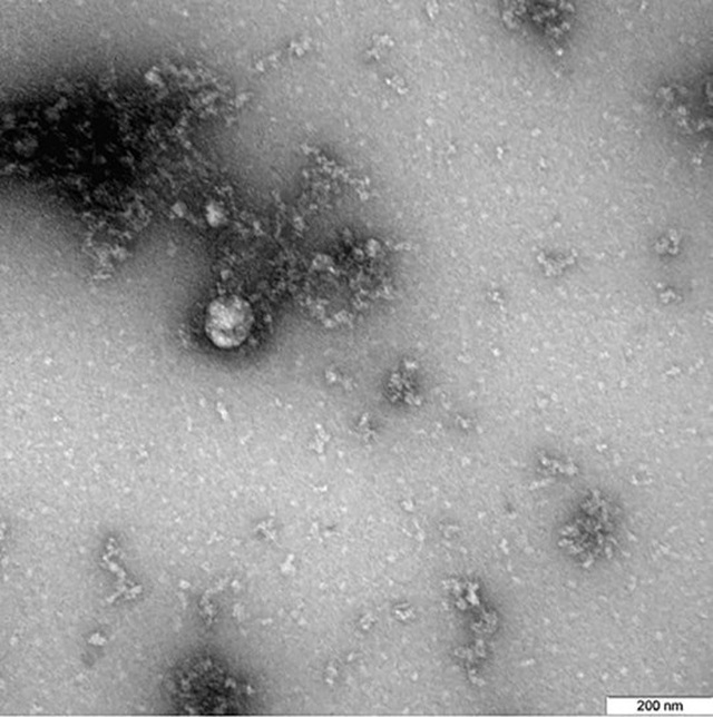 Hình ảnh dưới kính hiển vi của biến thể SARS-CoV-2 phát hiện ở Anh.