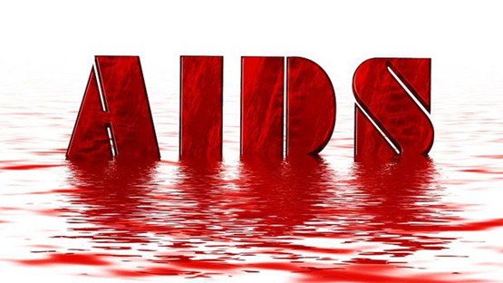Italia thử nghiệm thành công vaccine điều trị HIV/AIDS.