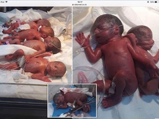 Ca sinh 7 đầu tiên mẹ tròn con vuông ở Iraq. Ảnh chụp màn hình Daily Mail