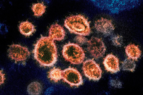 Hình ảnh virus SARS-CoV-2 dưới kính hiển vi
