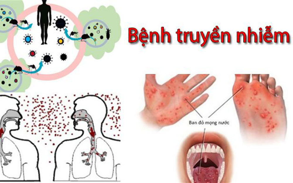 Triệu chứng chung của các bệnh truyền nhiễm