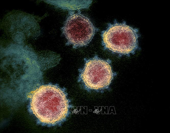 Hình ảnh từ kính hiển vi do Viện Y tế quốc gia Mỹ cung cấp cho thấy virus SARS-CoV-2 trong mẫu bệnh phẩm của bệnh nhân mắc COVID-19 ở Mỹ.