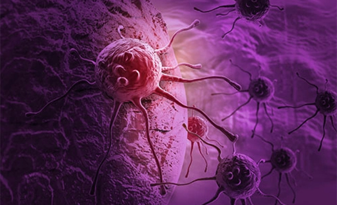 Triệu chứng ung thư gan Các dấu hiệu cần biết và cách phòng tránh