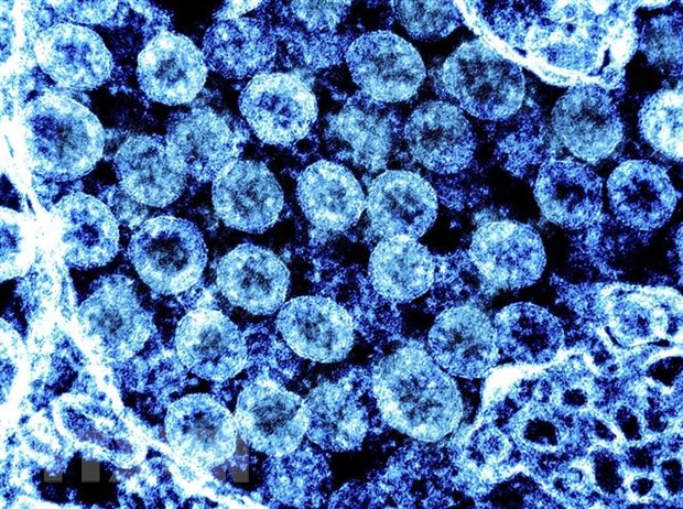 Phần tử virus SARS-CoV-2 trong mẫu bệnh phẩm của bệnh nhân mắc COVID-19.