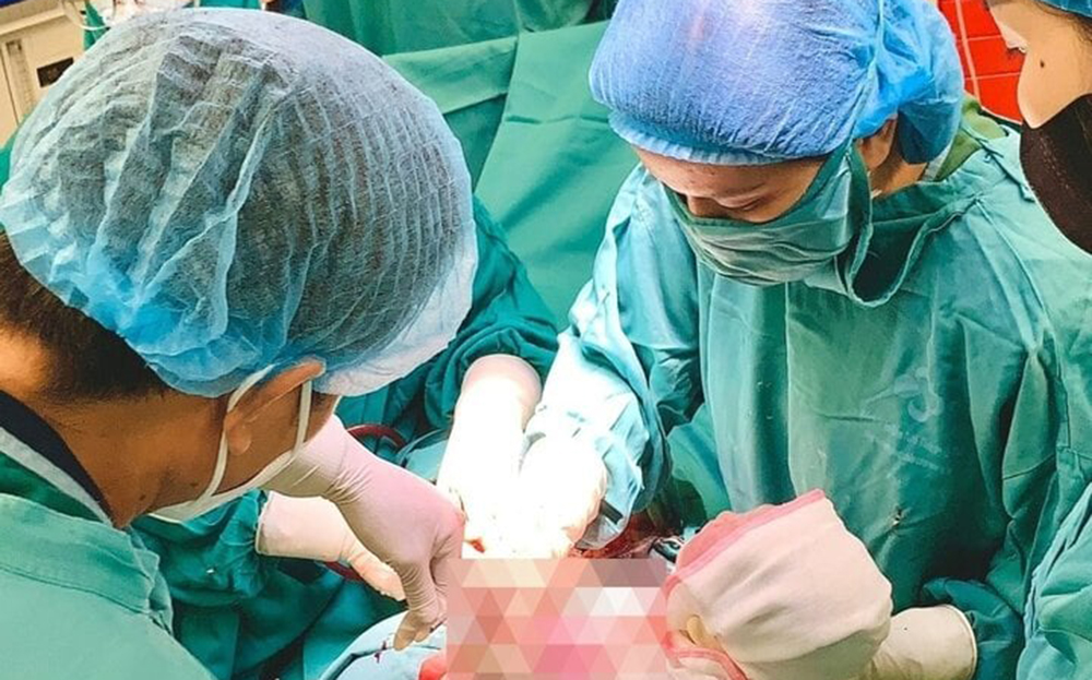 Các bác sĩ đón em bé chào đời kèm theo chiếc vòng tránh thai trên tay.