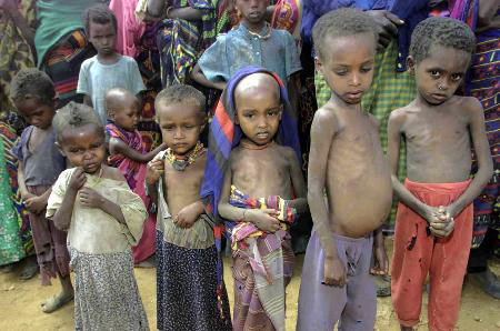 Mỗi ngày trên thế giới có trên 20.000 trẻ em dưới 5 tuổi bị chết đói là một con số ám ảnh mỗi chúng ta.