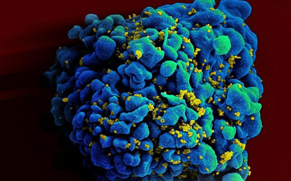 Hình ảnh hiển thị virus HIV đang xâm nhập vào tế bào T (tế bào miễn dịch).