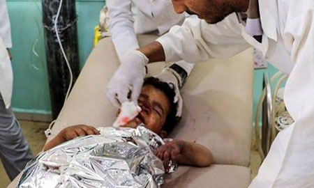 Một nạn nhân là trẻ em được điều trị tại bệnh viện ở Saada, Yemen sau vụ không kích ngày 9/8.