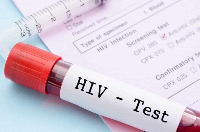 Xét nghiệm là cách duy nhất để biết tình trạng nhiễm HIV hay không.