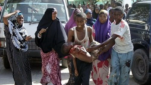 Một em bé bị thương trong vụ đụng độ giữa nhóm tấn công và binh lính Somalia hôm 16-9.