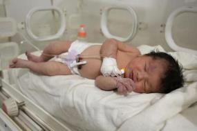 Em bé hiện đang được chăm sóc tại bệnh viện ở thị trấn Afrin (Syria). Ảnh: AFP