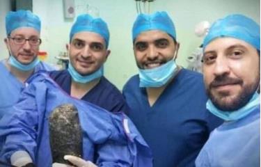 Các bác sĩ tại bệnh viện ở thủ đô Amman, Jordan cầm búi tóc được lấy khỏi bụng bệnh nhân 20 tuổi sau ca phẫu thuật tuần trước. Ảnh: Gulf News.