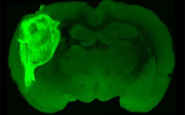 Tế bào não người được cấy ghép có gắn huỳnh quang trong một phần não chuột.