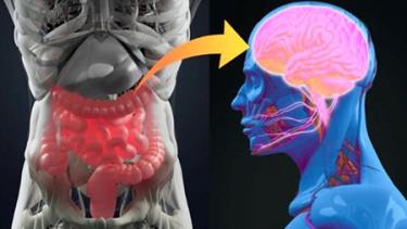 Bệnh Parkinson có thể bắt nguồn từ ruột thừa.