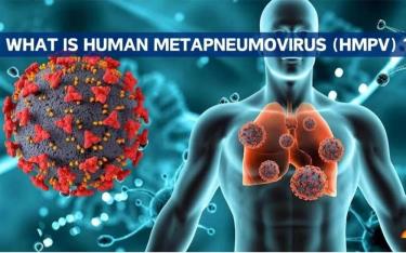 Virus HPMV gây viêm phổi ở người.