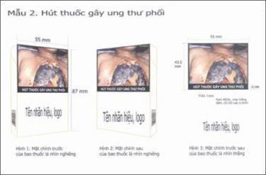 Mẫu 2: Hút thuốc lá gây ung thư phổi.