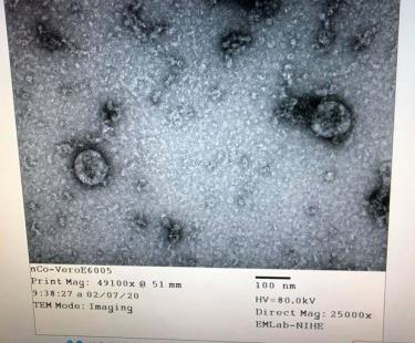 Việt Nam nuôi cấy và phân lập thành công virus corona chủng mới