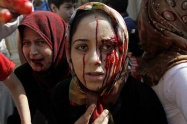 Nhiều dân thường Syria trở thành mục tiêu trong các cuộc tấn công của quân chính phủ.