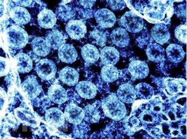 Phần tử virus SARS-CoV-2 trong mẫu bệnh phẩm của bệnh nhân mắc COVID-19.