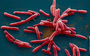 Hình ảnh vi khuẩn Burkholderia pseudomalei gây bệnh Whitmore. (Nguồn: Bộ Y tế)