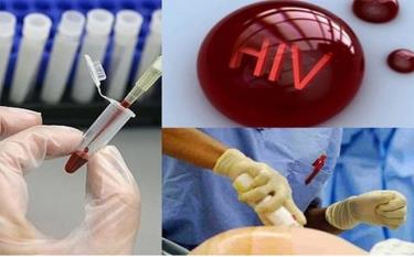 Điều kiện xác định người bị phơi nhiễm HIV, người bị nhiễm HIV do tai nạn rủi ro nghề nghiệp. (Ảnh: chinhphu.vn)
